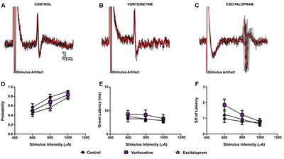 Impact of Vortioxetine on Synaptic Integration in Prefrontal-Subcortical Circuits: Comparisons with Escitalopram